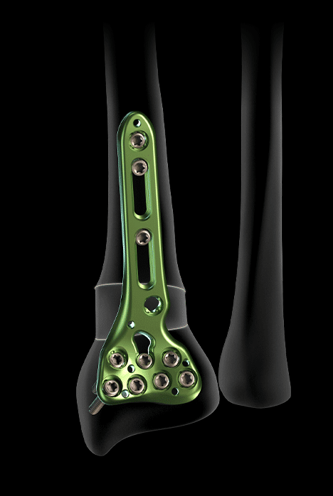 pe-xpert-wrist-7